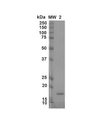 SDS-PAGE: Recombinant Mouse beta-Synuclein Active, Monomer Protein [NBP3-14776]